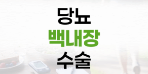 당뇨 백내장 수술: 성공적인 결과를 위한 필수 지식