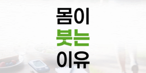 몸이 붓는 이유, 단순한 피로가 아닙니다: 부종의 원인과 관리법